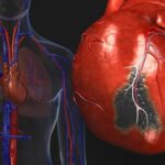 Know Your Risk Factors of Heart Failure