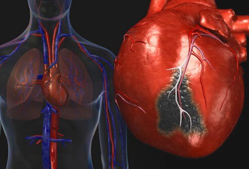  Know Your Risk Factors of Heart Failure
